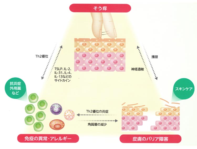 図1:Rerknimitr, P. et al : Inflamm Regen. 2017 (一部改変)