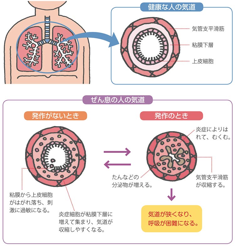 気道の図解